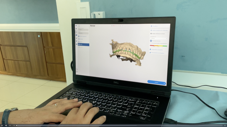 Intraoral scanning Technology
